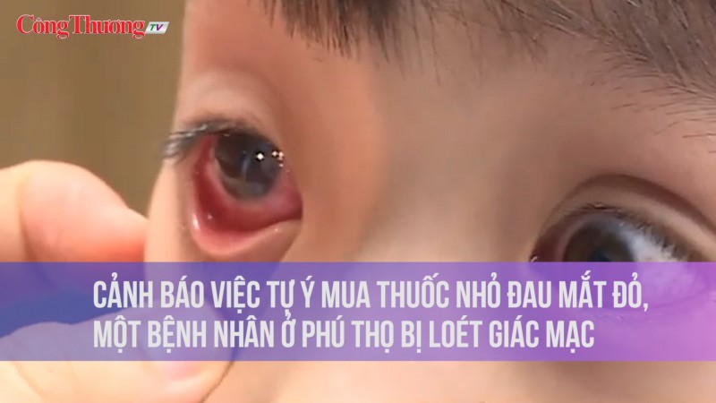 Cảnh báo việc tự ý mua thuốc nhỏ đau mắt đỏ, một bệnh nhân ở Phú Thọ bị loét giác mạc