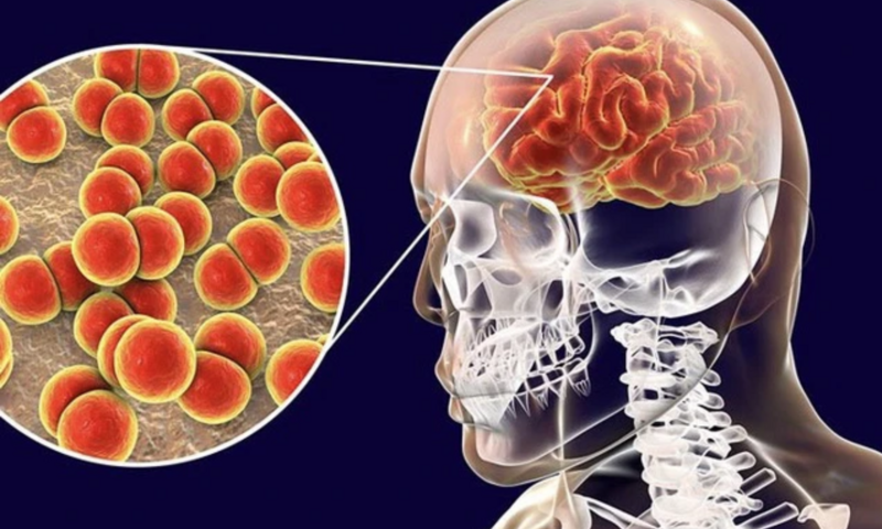 Gia tăng ca mắc não mô cầu: Phòng ngừa cách nào?