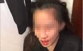 Quảng Ninh: Đã rõ nguyên nhân vụ chồng livestream đánh vợ đang mang bầu trên mạng xã hội