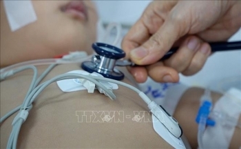 Ca mắc tay chân miệng gia tăng, Bộ Y tế yêu cầu cơ sở y tế sẵn sàng tiếp nhận ca nặng