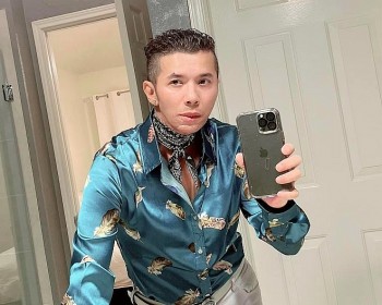 Kasim Hoàng Vũ xuất hiện với diện mạo khác lạ sau phẫu thuật hàm và cổ