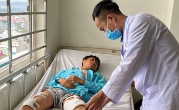 Đốt pháo tự chế, nam sinh lớp 6 bị thủy tinh găm vào người