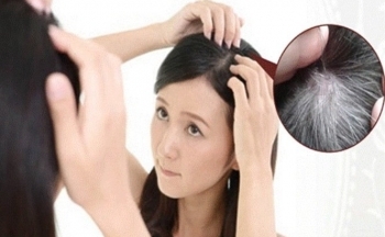 Tiết lộ phương pháp tự nhiên ngăn tóc bạc hiệu quả