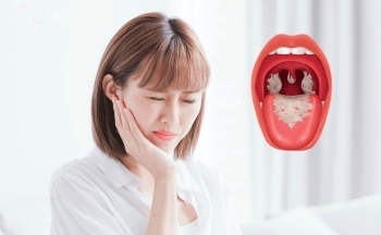 Chế độ dinh dưỡng giúp ''miễn dịch'' bệnh bạch hầu