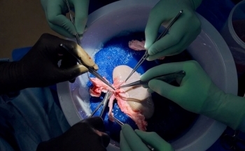 Bệnh viện Đa khoa tỉnh Lào Cai đủ điều kiện thực hiện ghép thận