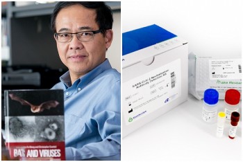 Thông tin bộ xét nghiệm kháng thể chống Covid-19