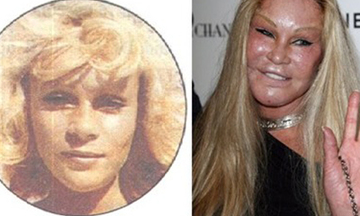 Những thảm họa thẩm mỹ đau lòng trong showbiz