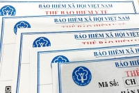 Vì sao thẻ bảo hiểm y tế mới không ghi ngày hết hạn sử dụng?