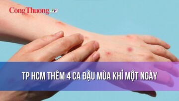 TP Hồ Chí Minh thêm 4 ca đậu mùa khỉ một ngày