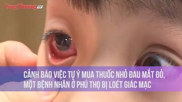 Cảnh báo việc tự ý mua thuốc nhỏ đau mắt đỏ, một bệnh nhân ở Phú Thọ bị loét giác mạc