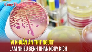 “Vi khuẩn ăn thịt người” làm nhiều bệnh nhân nguy kịch