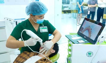 Trồng Răng Implant mất bao lâu tại Bệnh viện Răng Hàm Mặt Sài Gòn?