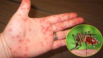 Dịch sốt xuất huyết diễn biến phức tạp: Bộ Y tế khuyến cáo gì? 