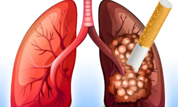 Thuốc lá: Thủ phạm gây bệnh phổi tắc nghẽn mạn tính