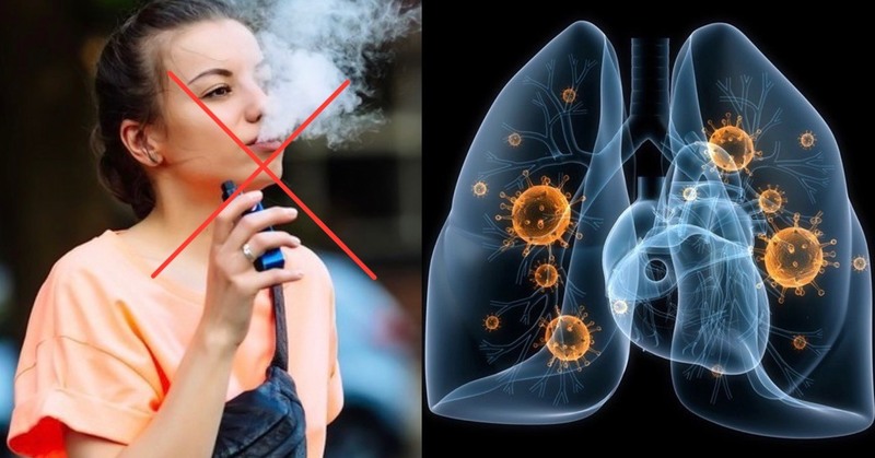 Thuốc lá điện tử là nguyên nhân trực tiếp dẫn đến hội chứng tổn thương phổi cấp tính (EVALI) (Hình minh họa).