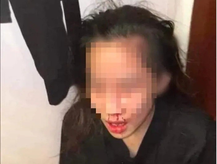 Quảng Ninh: Đã rõ nguyên nhân vụ chồng livestream đánh vợ đang mang bầu trên mạng xã hội Quảng Ninh: Đã rõ nguyên nhân vụ chồng livestream đánh vợ đang mang bầu trên mạng xã hội