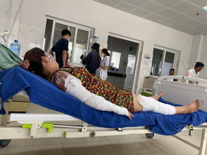 7 người bị bỏng nặng do bình gas mini phát nổ khi đang ăn lẩu. Ảnh: H.T 7 người bị bỏng nặng do bình gas mini phát nổ khi đang ăn lẩu. Ảnh: H.T