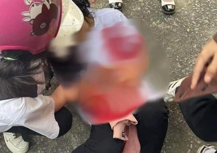 Do mâu thuẫn, nữ sinh lớp 10 dùng dao đâm 2 nữ sinh trọng thương. Do mâu thuẫn, nữ sinh lớp 10 dùng dao đâm 2 nữ sinh trọng thương.