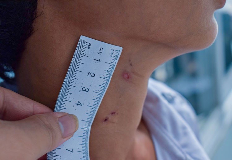 An Giang: Tạm giữ hình sự đối tượng bạo hành con riêng của vợ An Giang: Tạm giữ hình sự đối tượng bạo hành con riêng của vợ