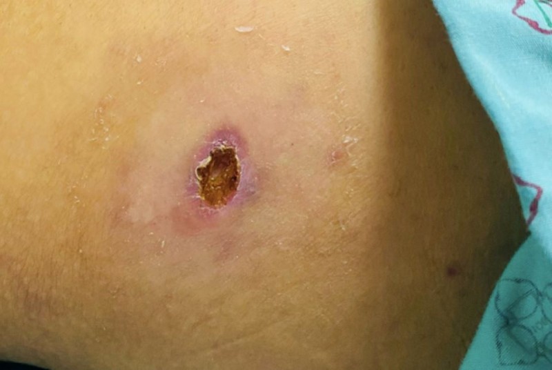 Yên Bái ghi nhận 290 ca mắc căn bệnh nguy hiểm, 1 ca đã tử vong Yên Bái ghi nhận 290 ca mắc căn bệnh nguy hiểm, 1 ca đã tử vong