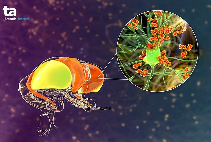 Các biện pháp phòng ngừa bệnh Whitmore "vi khuẩn ăn thịt người" Các biện pháp phòng ngừa bệnh Whitmore "vi khuẩn ăn thịt người"