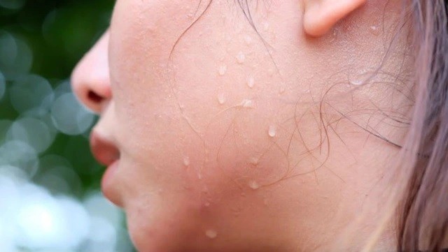 Những dấu hiệu bất thường khi thức giấc cảnh báo ung thư sớm Những dấu hiệu bất thường khi thức giấc cảnh báo ung thư sớm