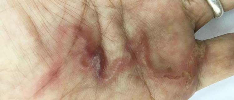 Nguy hiểm nhiễm ký sinh trùng từ thú cưng Nguy hiểm nhiễm ký sinh trùng từ thú cưng