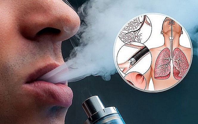 Báo động xu hướng thanh thiếu niên dùng thuốc lá điện tử, thuốc lá nung nóng