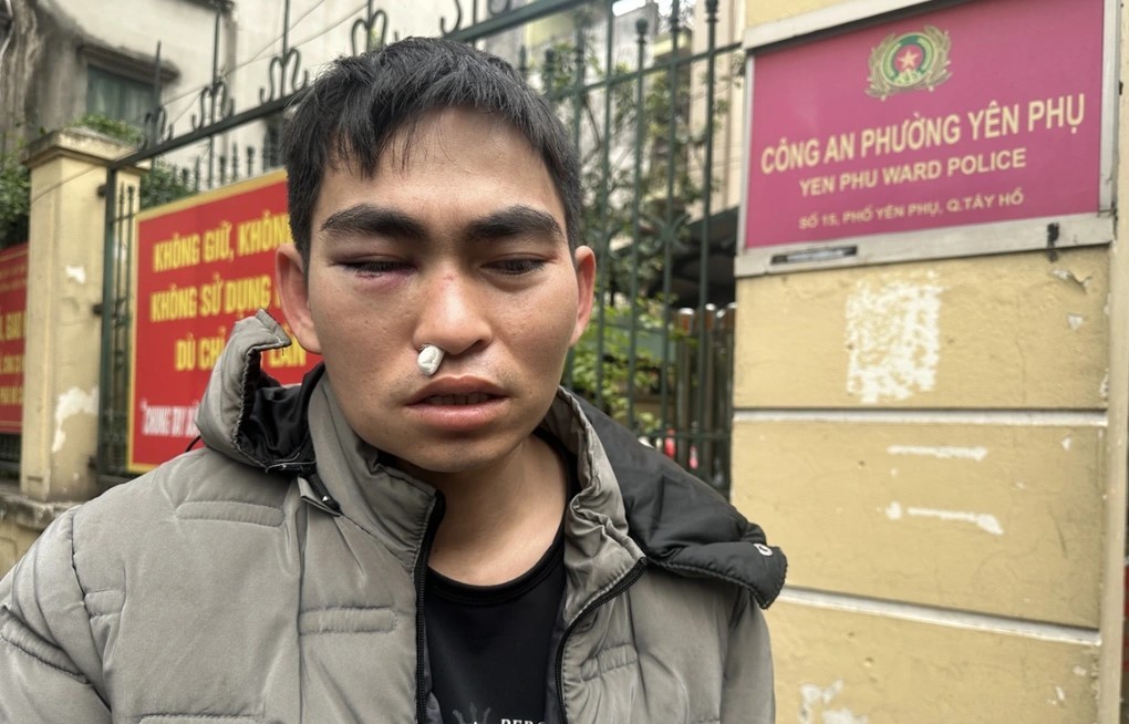 Cơ quan chức năng xác định, anh Hưng bị chấn động não tỷ lệ tổn hại thương tích là: 3%