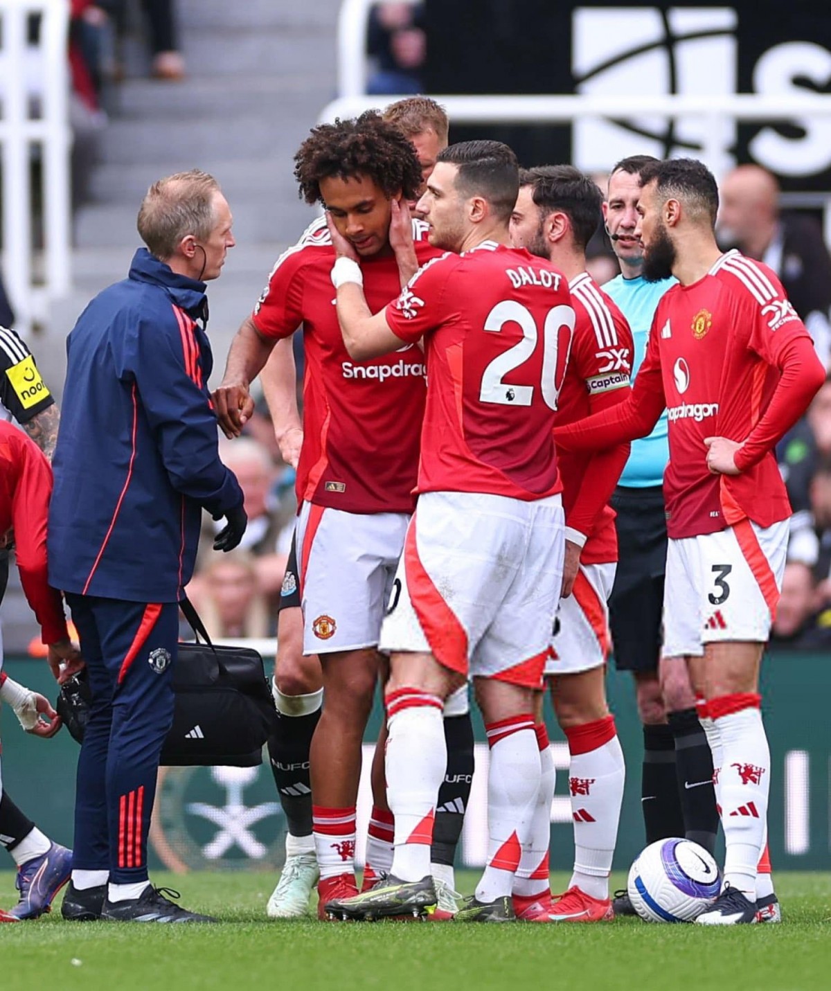 Zirkzee nhiều khả năng đã gặp chấn thương gân kheo sau trận đấu với Newcastle  Zirkzee nhiều khả năng đã gặp chấn thương gân kheo sau trận đấu với Newcastle