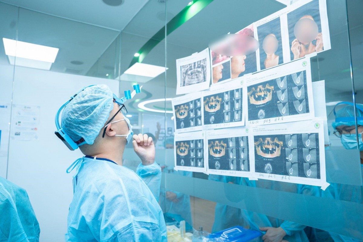 Trồng răng implant all on 4 tại Bệnh Viện Răng Hàm Mặt Sài Gòn Trồng răng implant all on 4 tại Bệnh Viện Răng Hàm Mặt Sài Gòn