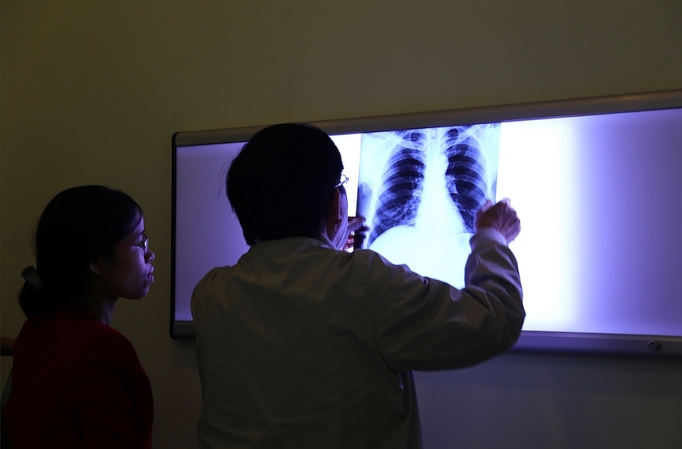 Ngành tấm lợp fibro xi măng và nỗi trăn trở 20 năm của doanh nghiệp nganh tam lop fibro xi mang va noi tran tro 20 nam cua doanh nghiep