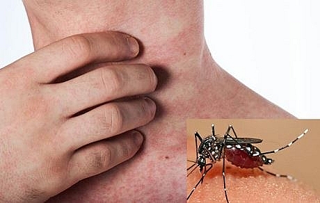 undefined 3655 unnamed