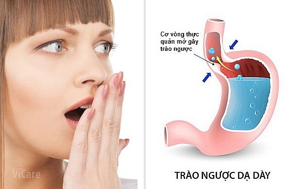 dau hieu trao nguoc da day ban nen biet