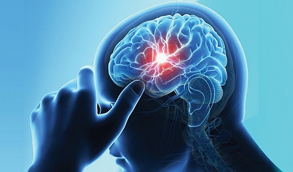 Chế độ ăn cho người bị đột quỵ che do an cho nguoi bi dot quy