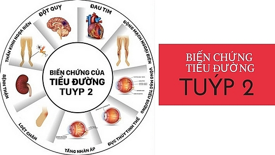 Các nguy cơ mắc bệnh của từng loại đái tháo đường cac nguy co mac benh cua tung loai dai thao duong