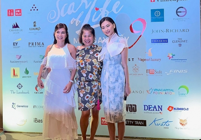 Diễn viên Ngô Thanh Vân công bố dự án gây quỹ mổ tim cho trẻ em nghèo dien vien ngo thanh van cong bo du an gay quy mo tim cho tre em ngheo