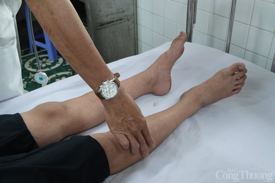 Đà Nẵng: Số ca sốt xuất huyết tăng mạnh Đà Nẵng: Số ca sốt xuất huyết tăng mạnh