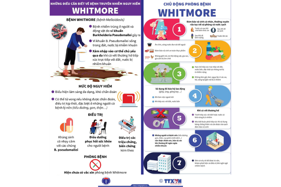 Điều cần biết về bệnh Whitemore và cách phòng tránh. (Ảnh: TTXVN) Điều cần biết về bệnh Whitemore và cách phòng tránh. (Ảnh: TTXVN)