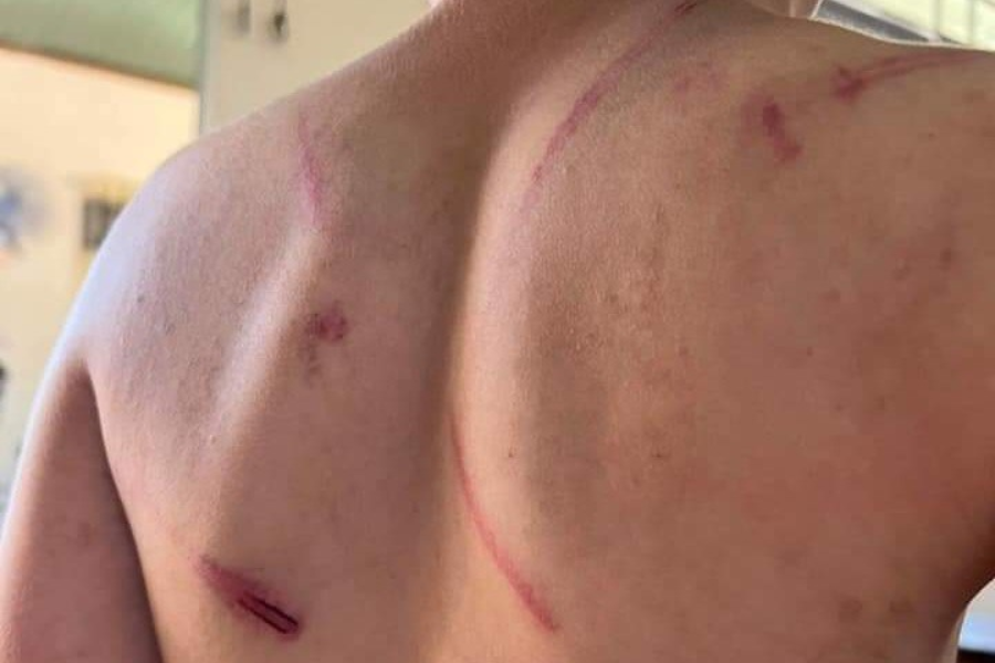 Đắk Lắk: Bé trai 9 tuổi bị bạo hành, khởi tố bà nội và cha ruột Đắk Lắk: Bé trai 9 tuổi bị bạo hành, khởi tố bà nội và cha ruột