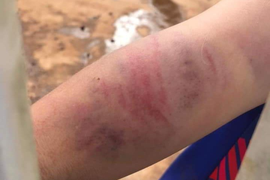 Đắk Lắk: Bé trai 9 tuổi bị bạo hành, khởi tố bà nội và cha ruột Đắk Lắk: Bé trai 9 tuổi bị bạo hành, khởi tố bà nội và cha ruột