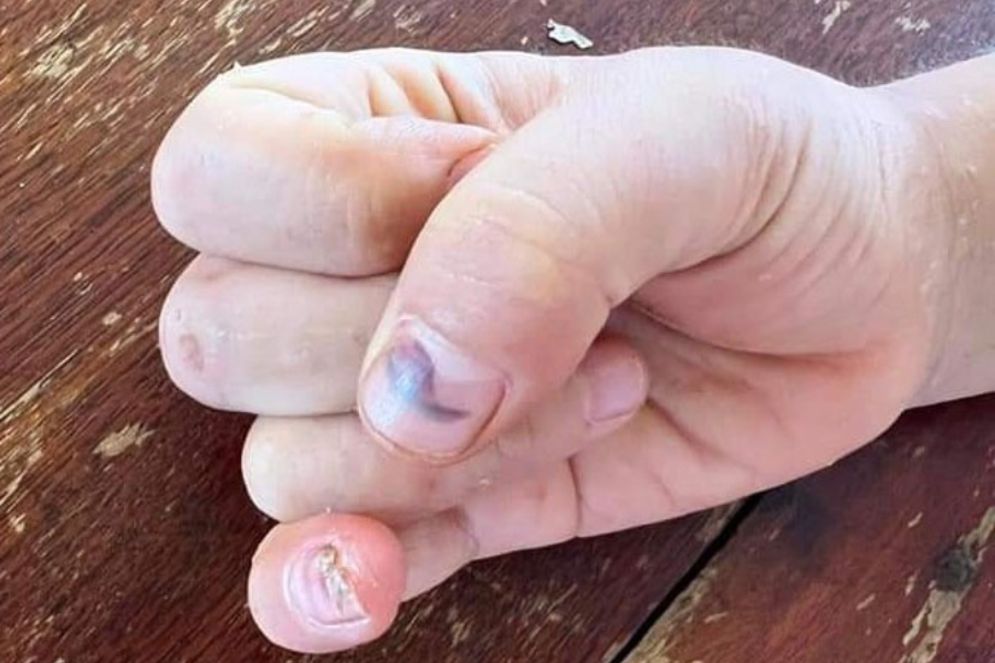 Đắk Lắk: Bé trai 9 tuổi bị bạo hành, khởi tố bà nội và cha ruột Đắk Lắk: Bé trai 9 tuổi bị bạo hành, khởi tố bà nội và cha ruột