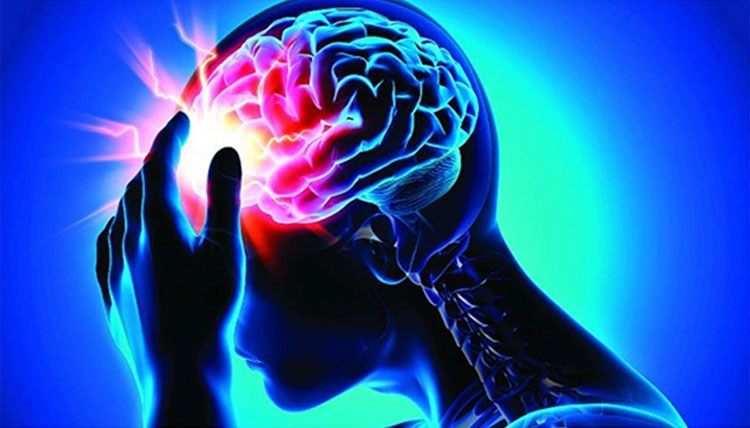 Tai biến mạch máu não, gây đột quỵ: Hệ quả và cách khắc phục tai bien mach mau nao gay dot quy he qua va cach khac phuc