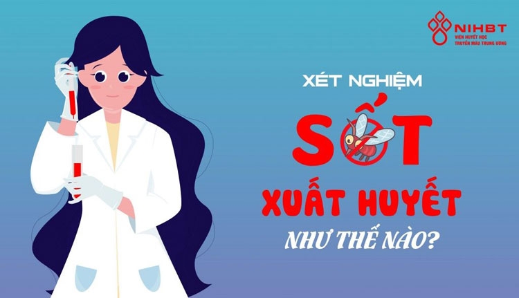Xét nghiệm sốt xuất huyết như thế nào? xet nghiem sot xuat huyet nhu the nao